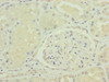 Immunohistochemistry of paraffin-embedded human kidney tissue using CSB-PA887959ESR2HU at dilution of 1:100