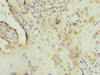 Immunohistochemistry of paraffin-embedded human placenta tissue using CSB-PA863146ESR2HU at dilution of 1:100