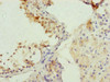 Immunohistochemistry of paraffin-embedded human testis tissue using CSB-PA005020ESR1HU at dilution of 1:100