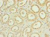 Immunohistochemistry of paraffin-embedded human kidney tissue using CSB-PA005020ESR1HU at dilution of 1:100