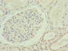 Immunohistochemistry of paraffin-embedded human kidney tissue using CSB-PA005020ESR2HU at dilution of 1:100