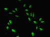 Immunofluorescent analysis of Hela cells using CSB-PA005020ESR2HU at dilution of 1:100 and Alexa Fluor 488-congugated AffiniPure Goat Anti-Rabbit IgG (H+L)
