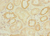 Immunohistochemistry of paraffin-embedded human kidney tissue using CSB-PA007632ESR1HU at dilution of 1:100