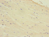 Immunohistochemistry of paraffin-embedded human heart tissue using CSB-PA010125ESR2HU at dilution of 1:100