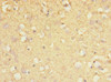 Immunohistochemistry of paraffin-embedded human brain tissue using CSB-PA873719DSR1HU at dilution of 1:100