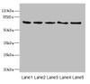 Western blot<br />
 All lanes: PLK3 antibody at 1.2µg/ml<br />
 Lane 1: Rat heart tissue<br />
 Lane 2: Hela whole cell lysate<br />
 Lane 3: 293T whole cell lysate<br />
 Lane 4: MCF-7 whole cell lysate<br />
 Lane 5: Monocytic leukemia cells in mice Macrophages<br />
 Secondary<br />
 Goat polyclonal to rabbit IgG at 1/10000 dilution<br />
 Predicted band size: 72 kDa<br />
 Observed band size: 72 kDa<br />