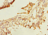 Immunohistochemistry of paraffin-embedded human testis tissue using CSB-PA880972ESR2HU at dilution of 1:100