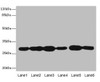 Western blot<br />
 All lanes: PMM2 antibody at 3.8µg/ml<br />
 Lane 1: A549 whole cell lysate<br />
 Lane 2: HepG2 whole cell lysate<br />
 Lane 3: MCF-7 whole cell lysate<br />
 Lane 4: K562 whole cell lysate<br />
 Lane 5: Hela whole cell lysate<br />
 Lane 6: 293T whole cell lysate<br />
 Secondary<br />
 Goat polyclonal to rabbit IgG at 1/10000 dilution<br />
 Predicted band size: 29, 14 kDa<br />
 Observed band size: 29 kDa<br />
