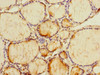 Immunohistochemistry of paraffin-embedded human thyroid tissue using CSB-PA018238ESR2HU at dilution of 1:100