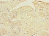 Immunohistochemistry of paraffin-embedded human heart tissue using CSB-PA613701DSR1HU at dilution of 1:100