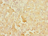Immunohistochemistry of paraffin-embedded human liver tissue using CSB-PA022386ESR1HU at dilution of 1:100