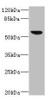 Western blot<br />
 All lanes: SOAT2 antibody IgG at 3.36µg/ml + 293T whole cell lysate<br />
 Secondary<br />
 Goat polyclonal to rabbit IgG at 1/10000 dilution<br />
 Predicted band size: 60, 58, 51, 35 kDa<br />
 Observed band size: 60 kDa<br />