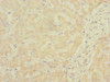 Immunohistochemistry of paraffin-embedded human liver tissue using CSB-PA022386ESR2HU at dilution of 1:100