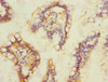 Immunohistochemistry of paraffin-embedded human small intestine tissue using CSB-PA022386ESR2HU at dilution of 1:100