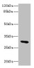 Western blot<br />
 All lanes: UPK3A antibody IgG at 1.76µg/ml + Mouse lung tissue<br />
 Secondary<br />
 Goat polyclonal to rabbit IgG at 1/10000 dilution<br />
 Predicted band size: 31, 18 kDa<br />
 Observed band size: 31 kDa<br />