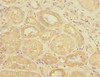 Immunohistochemistry of paraffin-embedded human kidney tissue using CSB-PA025657ESR2HU at dilution of 1:100