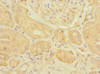 Immunohistochemistry of paraffin-embedded human kidney tissue using CSB-PA866204ESR1HU at dilution of 1:100