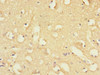 Immunohistochemistry of paraffin-embedded human brain tissue using CSB-PA892326ESR1HU at dilution of 1:100