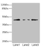 Western blot<br />
 All lanes: FBXO4 antibody at 3.1µg/ml<br />
 Lane 1: 293T whole cell lysate<br />
 Lane 2: HepG2 whole cell lysate<br />
 Lane 3: HL60 whole cell lysate<br />
 Secondary<br />
 Goat polyclonal to rabbit IgG at 1/10000 dilution<br />
 Predicted band size: 45, 36 kDa<br />
 Observed band size: 45 kDa<br />