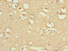 Immunohistochemistry of paraffin-embedded human brain tissue using CSB-PA891538ESR1HU at dilution of 1:100