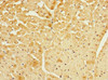 Immunohistochemistry of paraffin-embedded human heart tissue using CSB-PA891538ESR1HU at dilution of 1:100