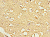 Immunohistochemistry of paraffin-embedded human brain tissue using CSB-PA891538ESR2HU at dilution of 1:100
