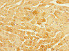 Immunohistochemistry of paraffin-embedded human heart tissue using CSB-PA891538ESR2HU at dilution of 1:100