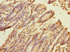 Immunohistochemistry of paraffin-embedded human duodenal tissue using CSB-PA822270ESR2HU at dilution of 1:100