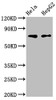 Western Blot<br />
 Positive WB detected in: Hela whole cell lysate, HepG2 whole cell lysate<br />
 All lanes: FRMD6 antibody at 3µg/ml<br />
 Secondary<br />
 Goat polyclonal to rabbit IgG at 1/50000 dilution<br />
 Predicted band size: 73, 71, 30 kDa<br />
 Observed band size: 73 kDa<br />