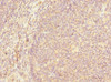 Immunohistochemistry of paraffin-embedded human tonsil tissue using CSB-PA521145ESR2HU at dilution of 1:100