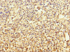 Immunohistochemistry of paraffin-embedded human spleen tissue using CSB-PA521145ESR2HU at dilution of 1:100