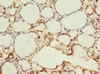 Immunohistochemistry of paraffin-embedded human thyroid tissue using CSB-PA896500ESR1HU at dilution of 1:100