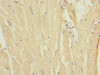 Immunohistochemistry of paraffin-embedded human heart tissue using CSB-PA889545ESR1HU at dilution of 1:100
