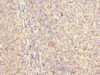 Immunohistochemistry of paraffin-embedded human tonsil tissue using CSB-PA769814ESR2HU at dilution of 1:100