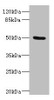 Western blot<br />
 All lanes: PTPN18 antibody IgG at 2.98µg/ml + Rat heart tissue<br />
 Secondary<br />
 Goat polyclonal to rabbit IgG at 1/10000 dilution<br />
 Predicted band size: 51, 39 kDa<br />
 Observed band size: 51 kDa<br />