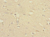 Immunohistochemistry of paraffin-embedded human brain tissue using CSB-PA858731ESR1HU at dilution of 1:100