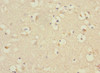 Immunohistochemistry of paraffin-embedded human brain tissue using CSB-PA858731ESR2HU at dilution of 1:100