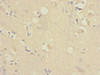 Immunohistochemistry of paraffin-embedded human brain tissue using CSB-PA019327ESR2HU at dilution of 1:100