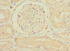 Immunohistochemistry of paraffin-embedded human kidney tissue using CSB-PA019327ESR2HU at dilution of 1:100