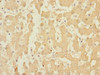 Immunohistochemistry of paraffin-embedded human liver tissue using CSB-PA820189ESR1HU at dilution of 1:100