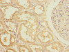 Immunohistochemistry of paraffin-embedded human kidney tissue using CSB-PA019349ESR2HU at dilution of 1:100