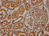 IHC image of CSB-PA754570ESR2HU diluted at 1:263 and staining in paraffin-embedded human kidney tissue performed on a Leica BondTM system. After dewaxing and hydration, antigen retrieval was mediated by high pressure in a citrate buffer (pH 6.0) . Section was blocked with 10% normal goat serum 30min at RT. Then primary antibody (1% BSA) was incubated at 4°C overnight. The primary is detected by a biotinylated secondary antibody and visualized using an HRP conjugated SP system.