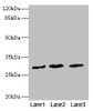 Western blot<br />
 All lanes: RCHY1 antibody at 3.98µg/ml<br />
 Lane 1: SH-SY5Y whole cell lysate<br />
 Lane 2: 293T whole cell lysate<br />
 Lane 3: Hela whole cell lysate<br />
 Secondary<br />
 Goat polyclonal to rabbit IgG at 1/10000 dilution<br />
 Predicted band size: 31, 29, 21, 22, 9, 28, 26, 25 kDa<br />
 Observed band size: 31 kDa<br />