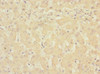 Immunohistochemistry of paraffin-embedded human liver tissue using CSB-PA822281ESR1HU at dilution of 1:100
