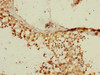 Immunohistochemistry of paraffin-embedded human testis tissue using CSB-PA019646ESR2HU at dilution of 1:100