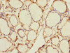 Immunohistochemistry of paraffin-embedded human thyroid tissue using CSB-PA019684ESR1HU at dilution of 1:100