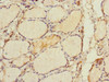 Immunohistochemistry of paraffin-embedded human thyroid tissue using CSB-PA019684ESR2HU at dilution of 1:100