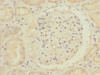 Immunohistochemistry of paraffin-embedded human kidney tissue using CSB-PA019684ESR2HU at dilution of 1:100