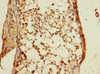 Immunohistochemistry of paraffin-embedded human testis tissue using CSB-PA007213ESR2HU at dilution of 1:100