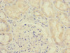 Immunohistochemistry of paraffin-embedded human kidney tissue using CSB-PA875672ESR1HU at dilution of 1:100